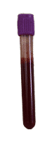 Purple Top Blood Tube